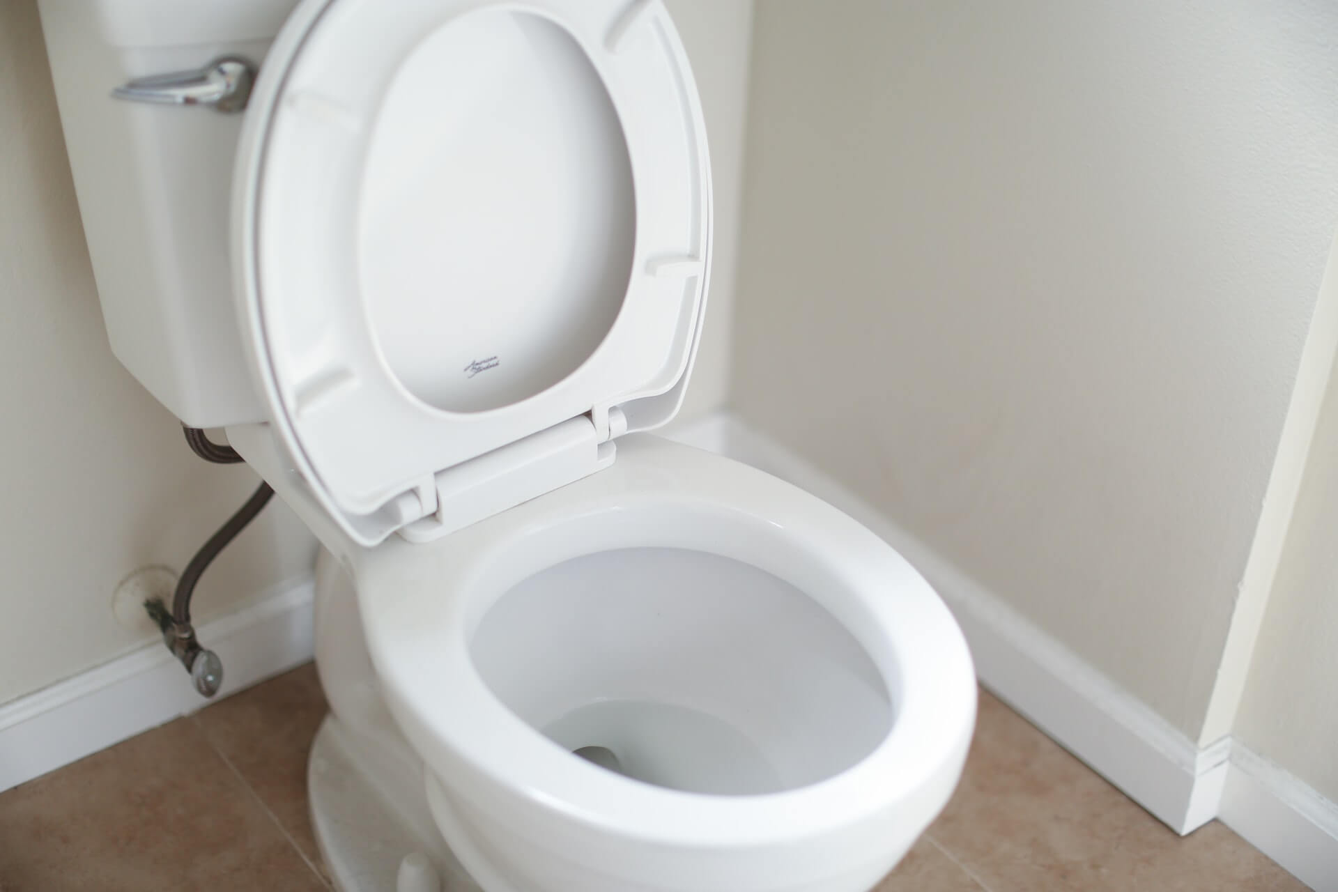 5 Causes of Toilet Overflow You Should Know About
